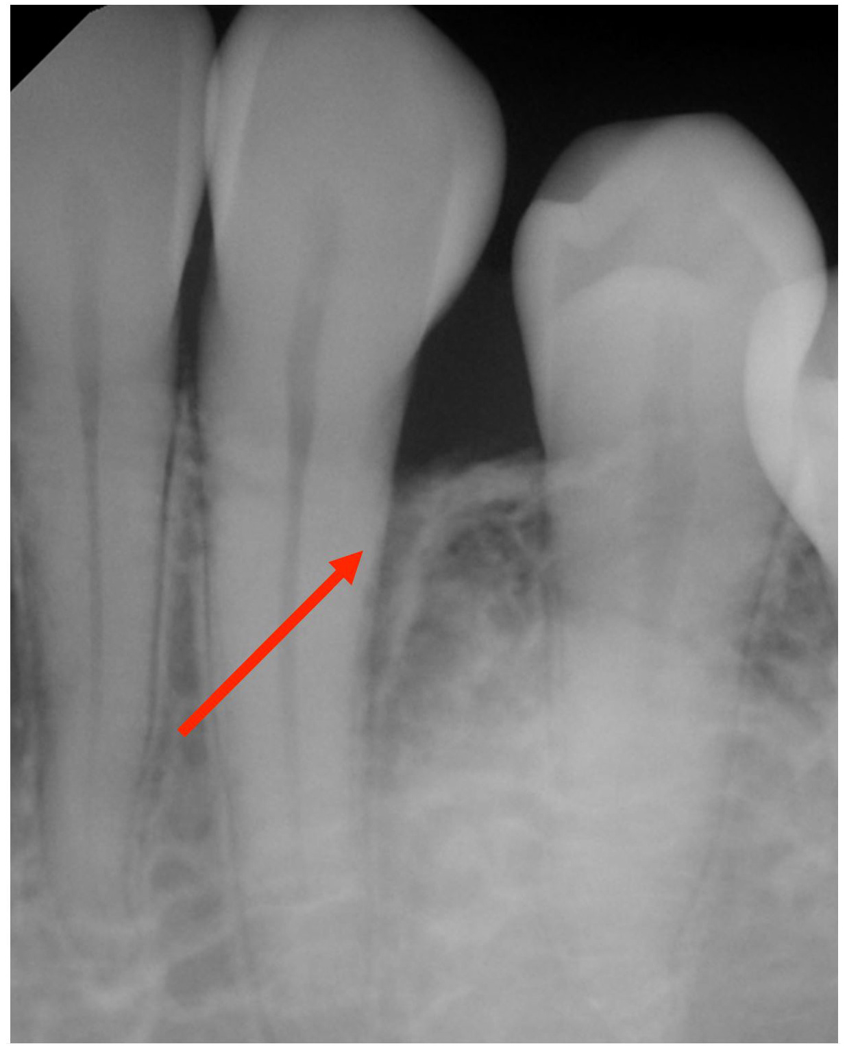 gum-grafting gallery
